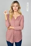Striped Button Down Tunic